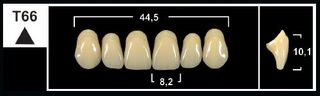 T66 D4 UPPER ANTERIOR TRIBOS TEETH