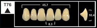 T76 D4 UPPER ANTERIOR TRIBOS TEETH