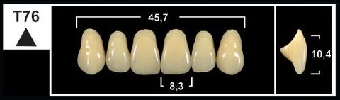 T76 C4 UPPER ANTERIOR TRIBOS TEETH