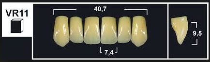 VR11 A1 UPPER ANTERIOR TRIBOS TEETH