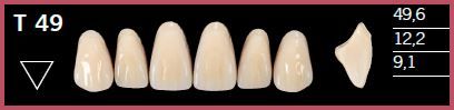 T49-A3.5 DELARA TEETH UPPER ANTERIOR