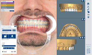 CERAMILL M-SMILE