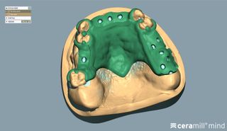 CERAMILL M-PART