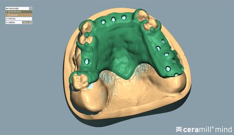 CERAMILL M-PART