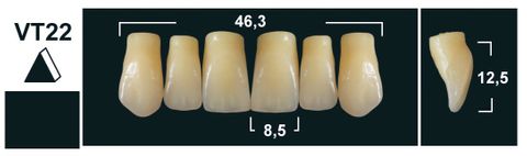 VT22 A1 UPPER ANTERIOR TRIBOS TEETH