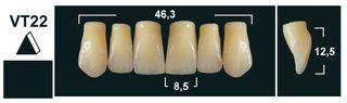 VT22 A1 UPPER ANTERIOR TRIBOS TEETH