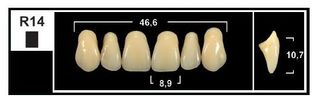 R14 BL3 UPPER ANTERIOR TRIBOS TEETH