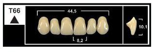 T66 BL3 UPPER ANTERIOR TRIBOS TEETH