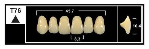 T76 BL3 UPPER ANTERIOR TRIBOS TEETH