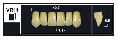 VR11 BL3 UPPER ANTERIOR TRIBOS TEETH