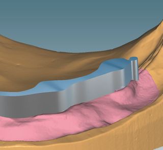 CERAMILL M BARS