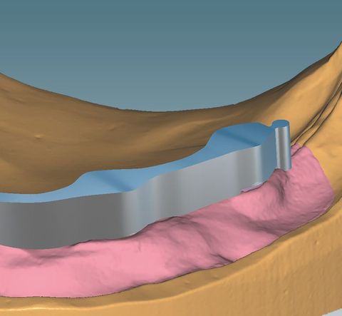 CERAMILL M BARS