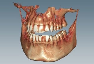 CERAMILL DICOM VIEWER