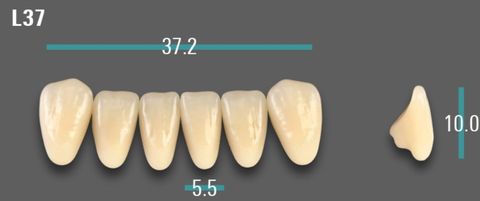 VITA VIONIC VIGO Anterior, 0M1, L37