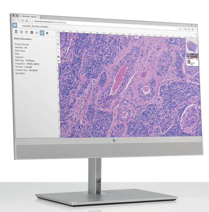 UltraScan HP Computer