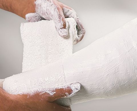 PLASTER BANDAGES