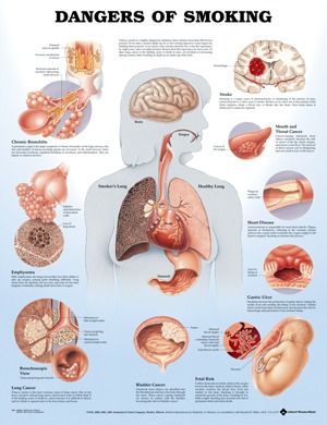 Chart Dangers of Smoking
