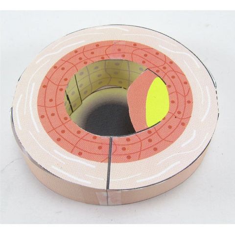 Cardiovascular Disease